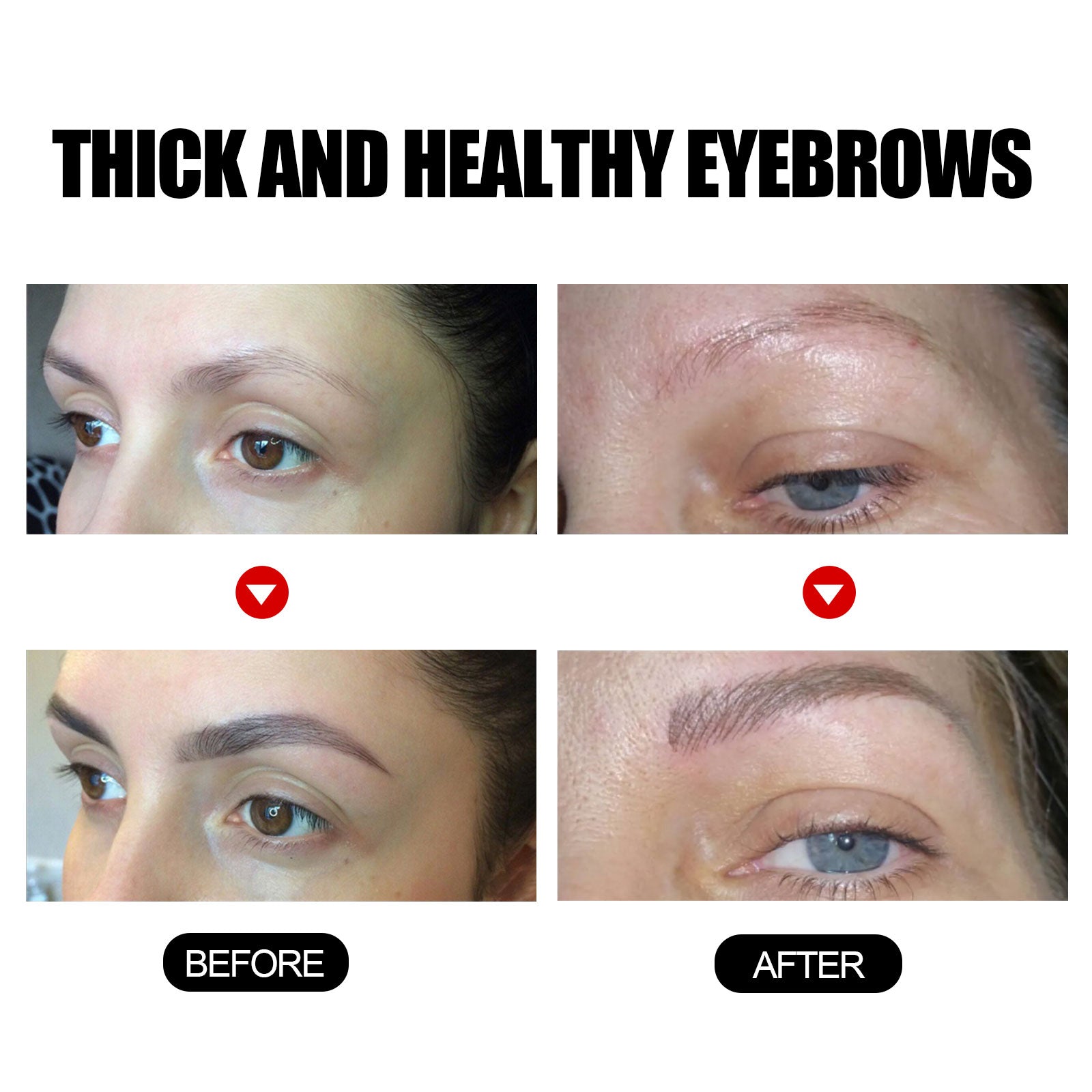 Eyebrow Growth Treatment