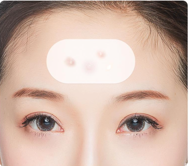 Blackhead removal patch