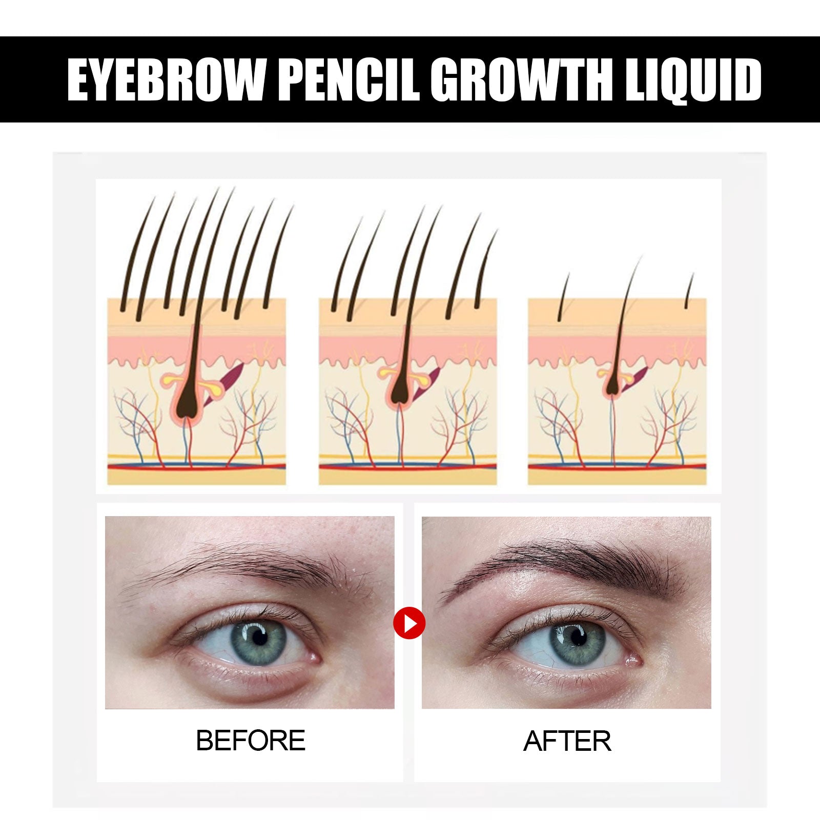 Eyebrow Growth Treatment
