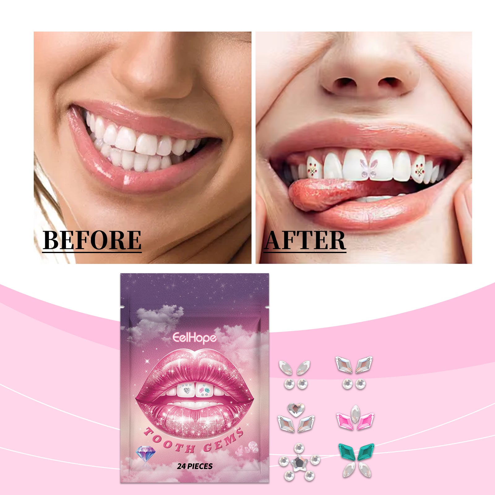 Tooth gems