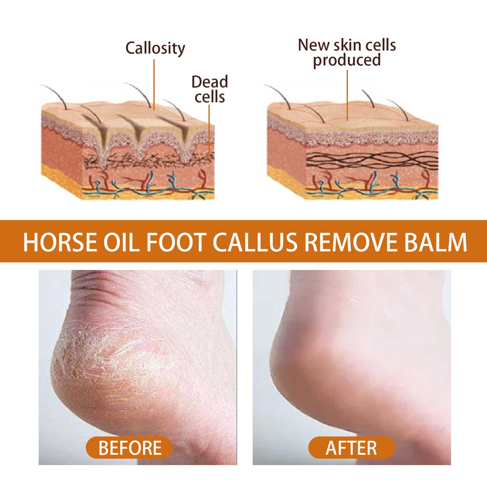 Horse Oil Foot Care Cream, Repair Heel Peeling Anti-Cracking Moisturizing Foot Care Cream