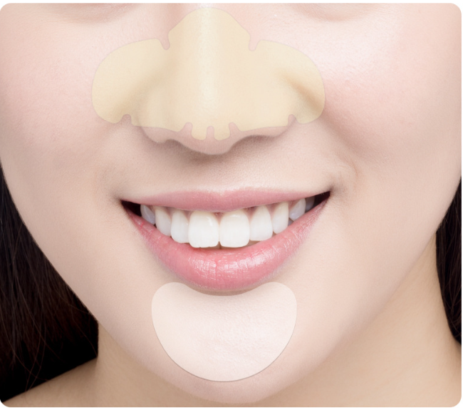 Blackhead removal patch