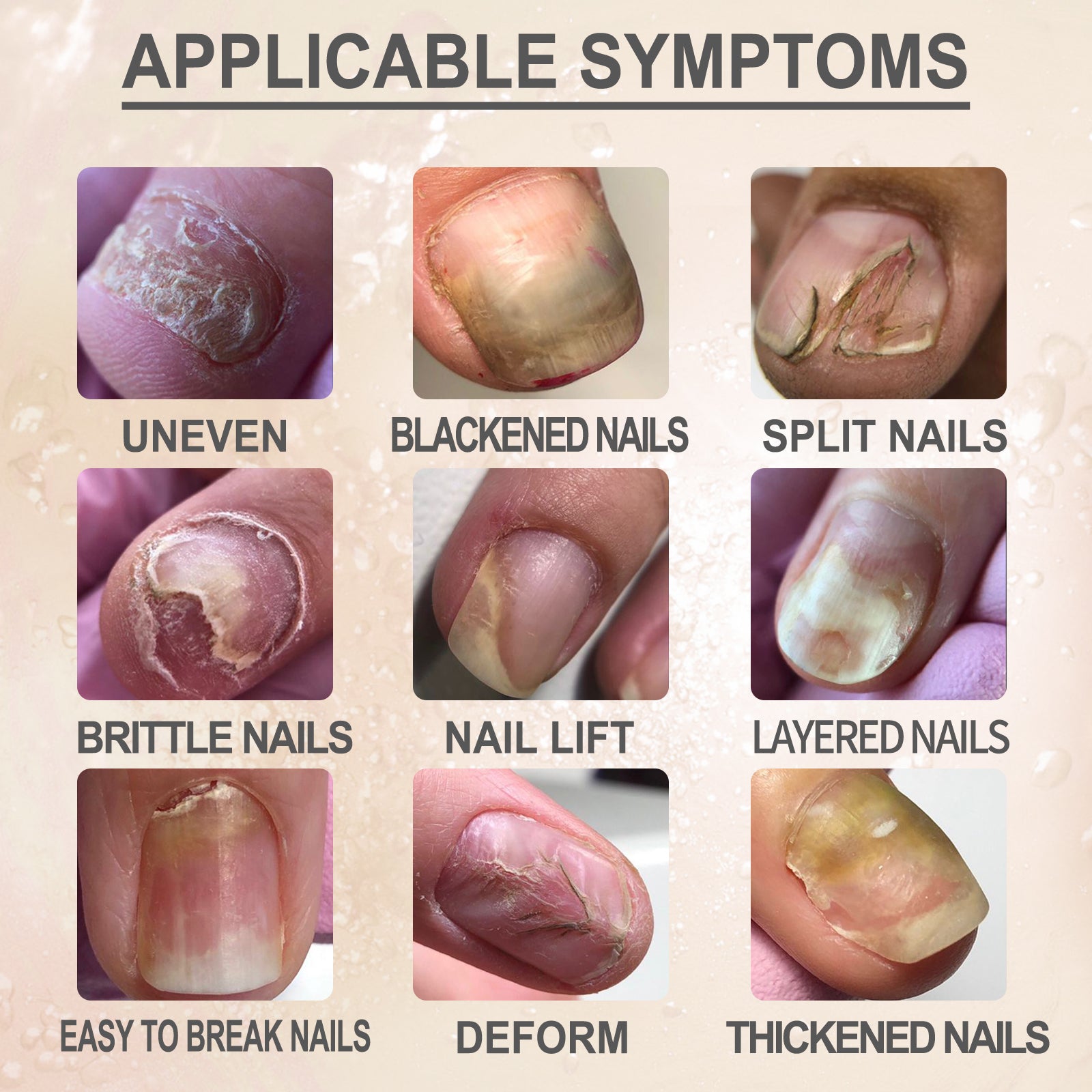 7 Day Nail Repair and strengthening Nail serum